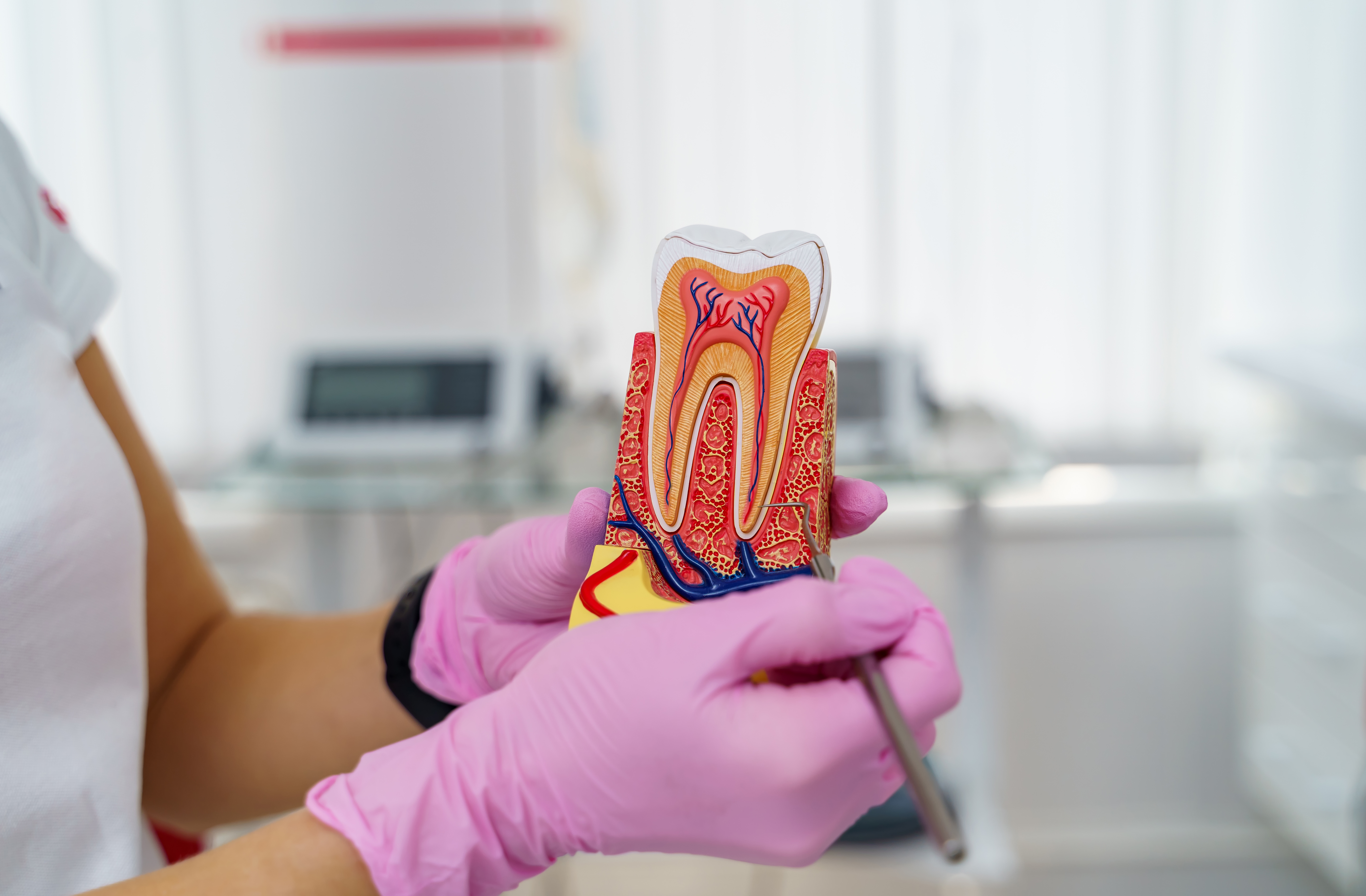 FAQs About Root Canal Treatment